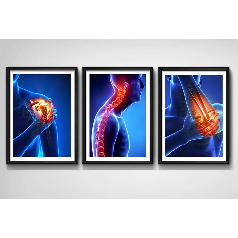 Set 3 Cuadros Ortopedia Rayos X Cuerpo Humano Medicina Decor