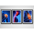 Set 3 Cuadros Ortopedia Rayos X Cuerpo Humano Medicina Decor
