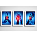 Set 3 Cuadros Ortopedia Manos Rayos X Cuerpo Humano Medicina