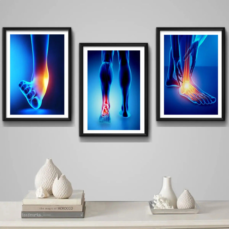 Set 3 Cuadros Ortopedia Piés Rayos X Cuerpo Humano Medicina