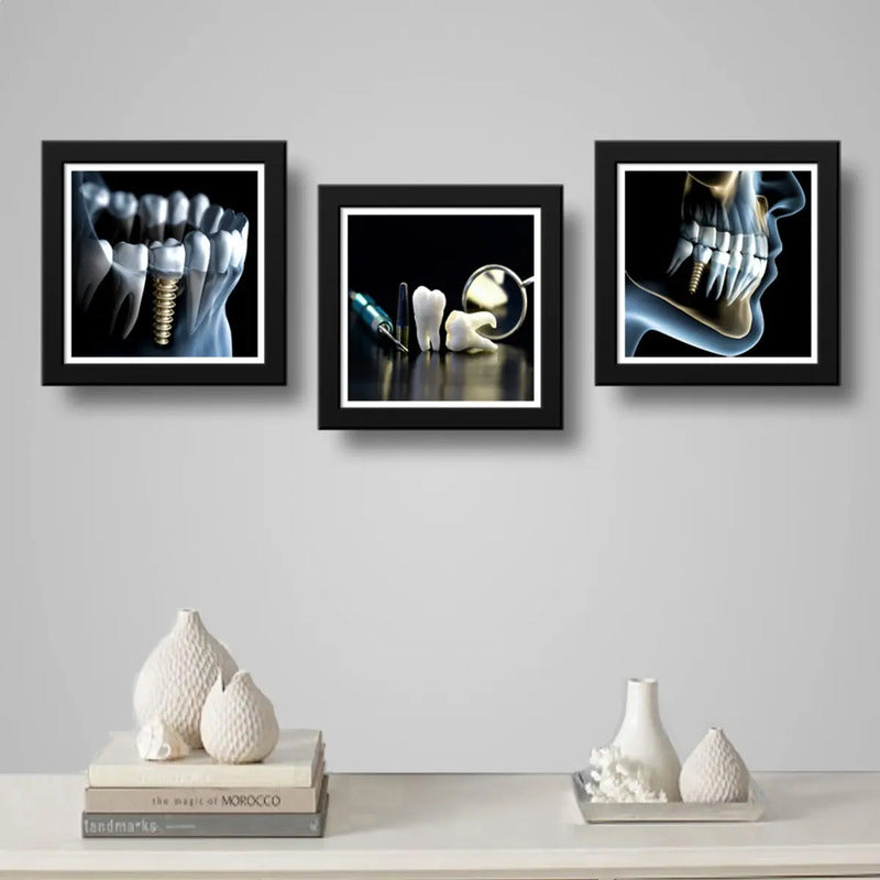 Set 3 Cuadros Implantes Dentales Dentista Clinica Estética
