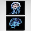 Set 2 Cuadros Neurología Médico Cuerpo Humano Decoracion