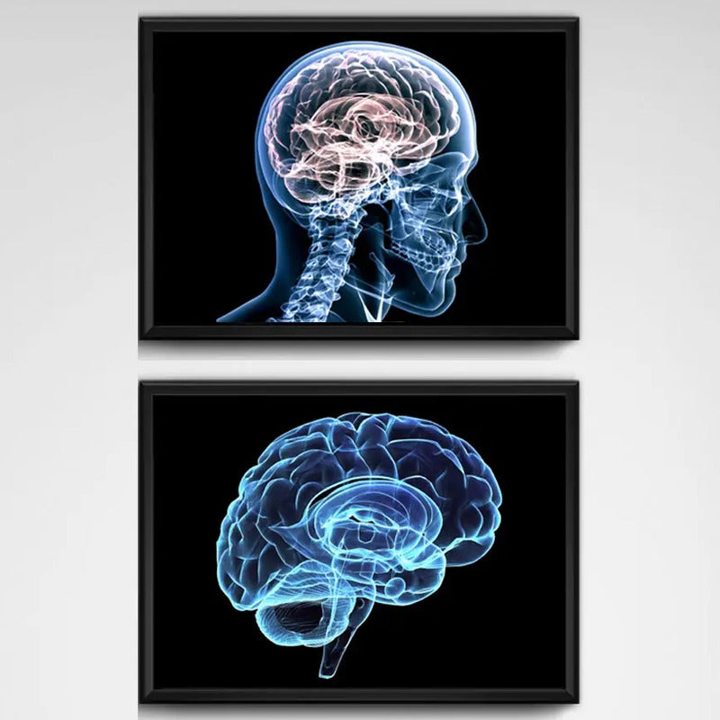 Set 2 Cuadros Neurología Médico Cuerpo Humano Decoracion