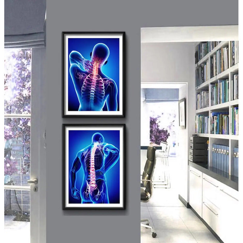 Set 2 Cuadros Ortopedia Médico Rayos X Cuerpo Humano Clinica