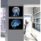 Set 2 Cuadros Neurología Médico Cuerpo Humano Decoracion