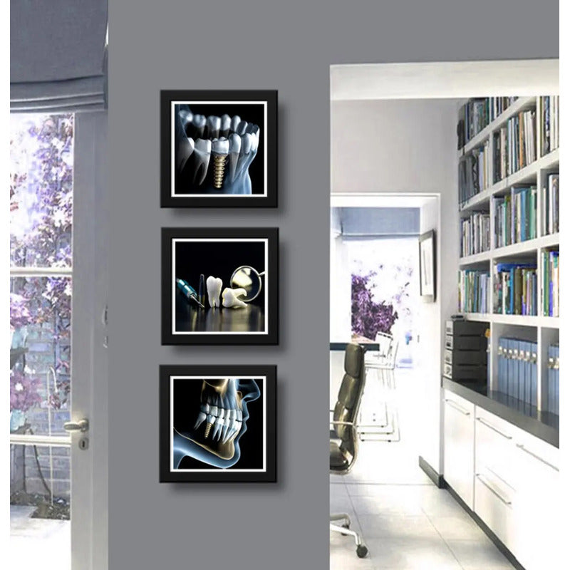 Set 3 Cuadros Implantes Dentales Dentista Clinica Estética