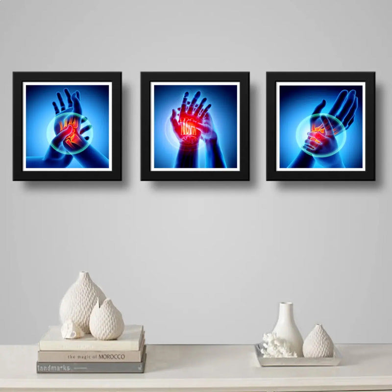 Set 3 Cuadros Ortopedia Manos Rayos X Cuerpo Humano Clinica