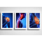 Set 3 Cuadros Ortopedia Rayos X Cuerpo Humano Medicina Decor