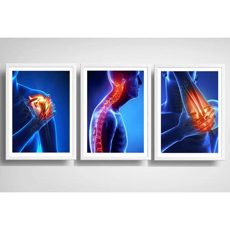 Set 3 Cuadros Ortopedia Rayos X Cuerpo Humano Medicina Decor