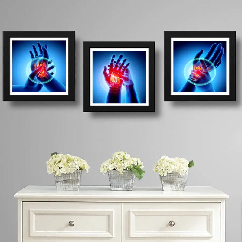 Set 3 Cuadros Ortopedia Manos Rayos X Decorar Clinica 33cm Marco Negro