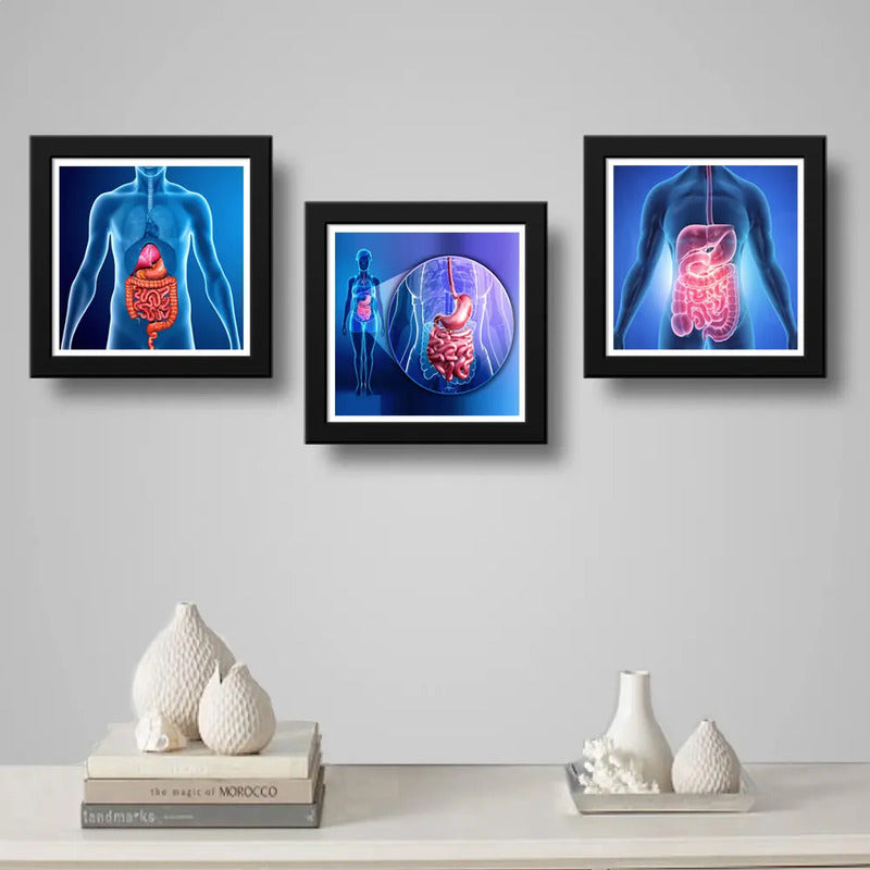 Set 3 Cuadros Gastroenterología Médico Cuerpo Humano Clinica