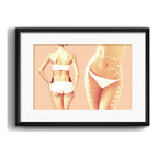 Cuadro Estetica Plastica Botox Lipo Clinica Arte Paspartu
