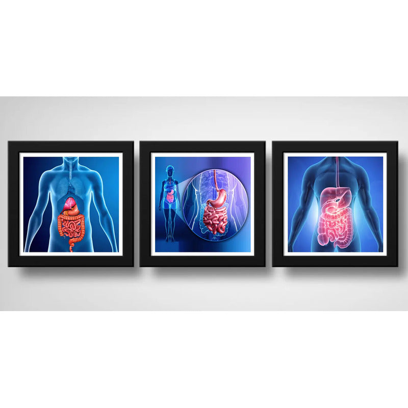Set 3 Cuadros Gastroenterología Médico Cuerpo Humano Clinica