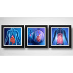 Set 3 Cuadros Gastroenterología Médico Cuerpo Humano Clinica