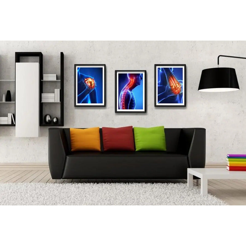 Set 3 Cuadros Ortopedia Rayos X Cuerpo Humano Medicina Decor