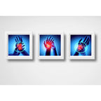 Set 3 Cuadros Ortopedia Manos Rayos X Cuerpo Humano Clinica