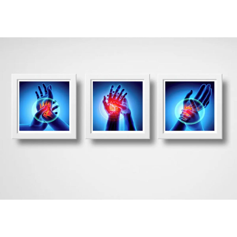 Set 3 Cuadros Ortopedia Manos Rayos X Cuerpo Humano Clinica