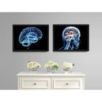 Set 2 Cuadros Neurología Médico Cuerpo Humano Decoracion