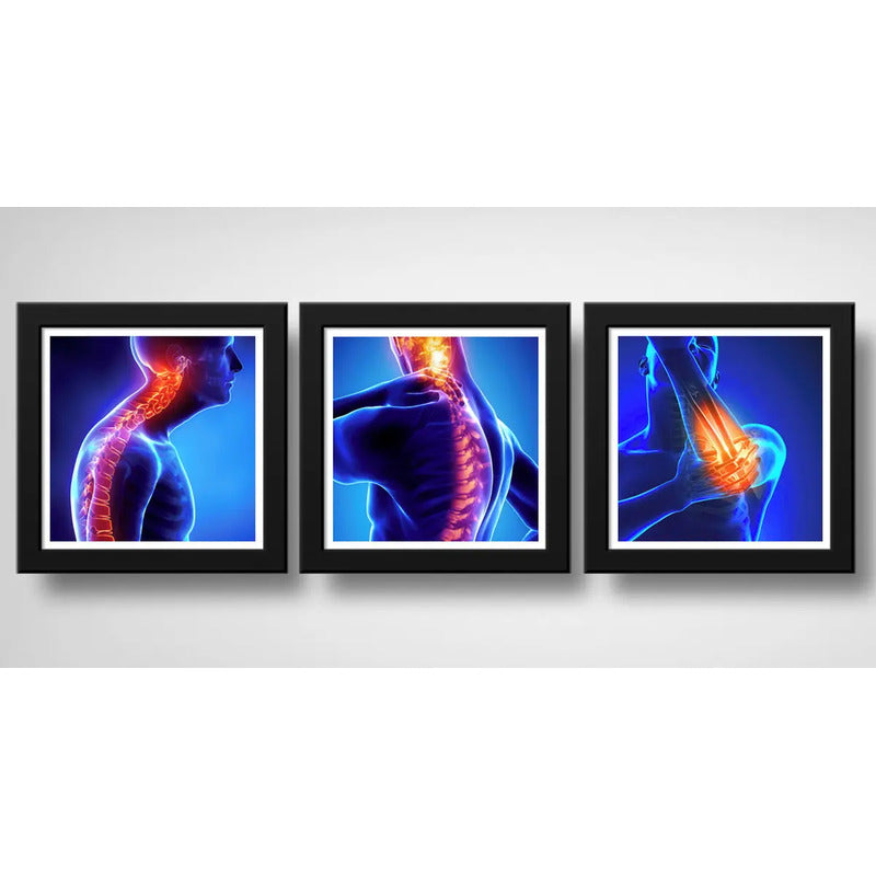 Set 3 Cuadros Ortopedia Rayos X Cuerpo Humano Clinica Medica