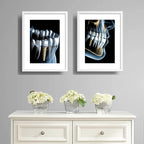Set 2 Cuadros Implantes Dentales Dentista Clinica Paspartú