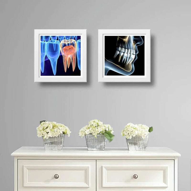 Set 2 Cuadros Implantes Dentales Dentista Clinica Decoracion
