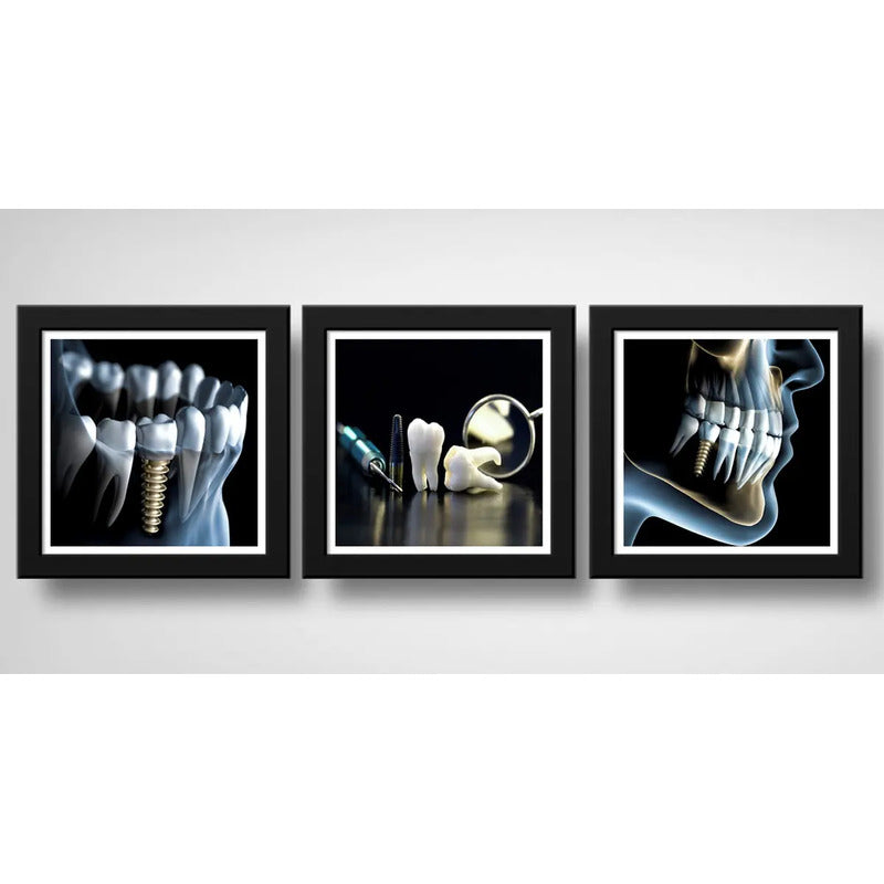 Set 3 Cuadros Implantes Dentales Dentista Clinica Estética
