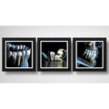 Set 3 Cuadros Implantes Dentales Dentista Clinica Estética