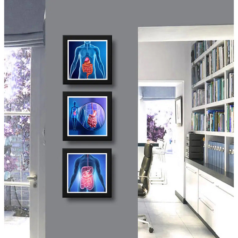 Set 3 Cuadros Gastroenterología Médico Cuerpo Humano Clinica