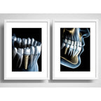 Set 2 Cuadros Implantes Dentales Dentista Clinica Paspartú