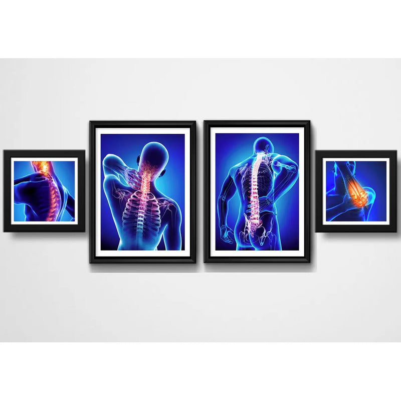 Set 4 Cuadros Ortopedia Rayos X Cuerpo Humano Clinica Medica