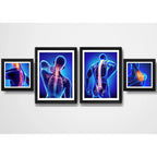 Set 4 Cuadros Ortopedia Rayos X Cuerpo Humano Clinica Medica