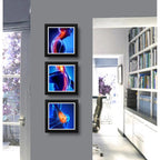 Set 3 Cuadros Ortopedia Rayos X Cuerpo Humano Clinica Medica