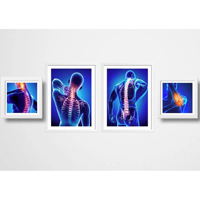 Set 4 Cuadros Ortopedia Rayos X Cuerpo Humano Clinica Medica
