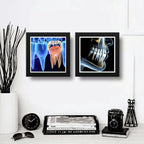 Set 2 Cuadros Implantes Dentales Dentista Clinica Decoracion