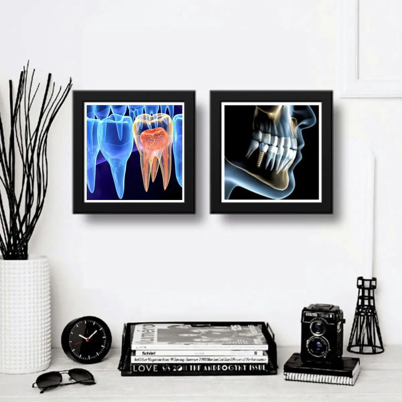 Set 2 Cuadros Implantes Dentales Dentista Clinica Decoracion