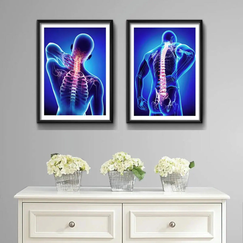 Set 2 Cuadros Ortopedia Médico Rayos X Cuerpo Humano Clinica