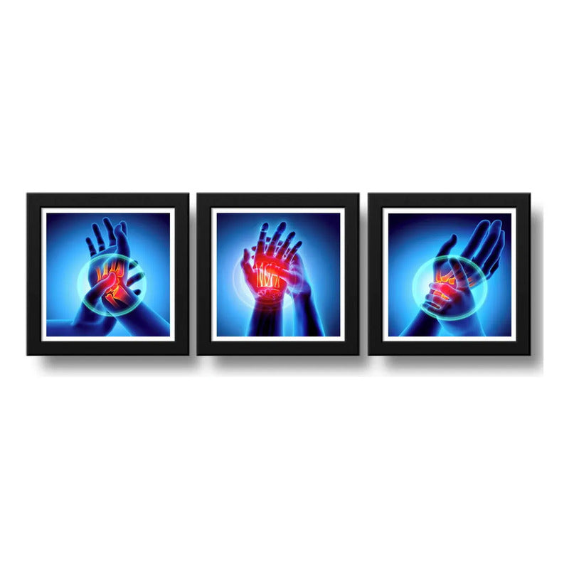 Set 3 Cuadros Ortopedia Manos Rayos X Cuerpo Humano Clinica