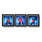 Set 3 Cuadros Ortopedia Manos Rayos X Cuerpo Humano Clinica