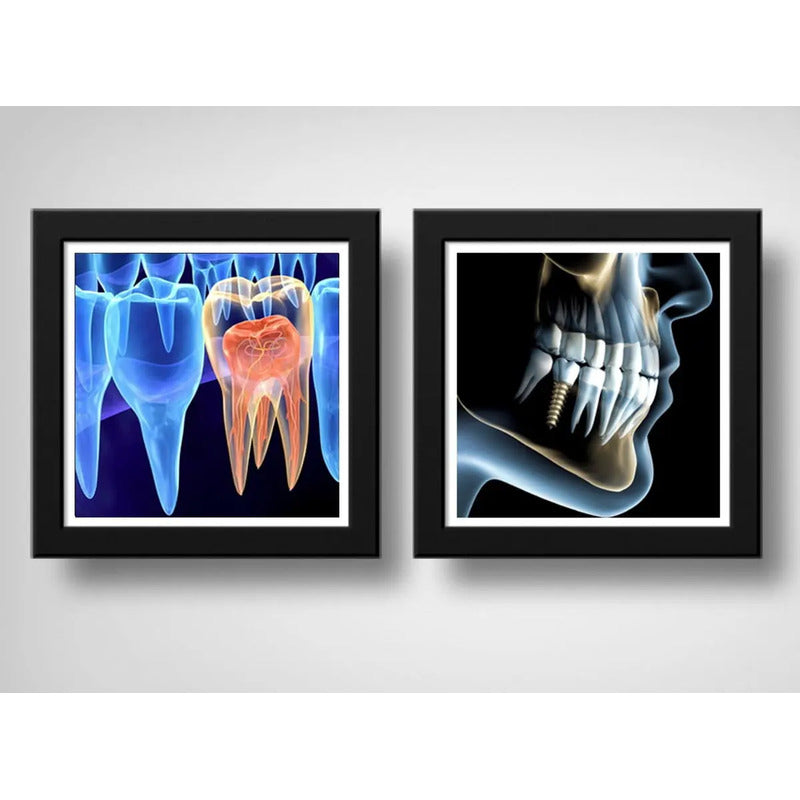 Set 2 Cuadros Implantes Dentales Dentista Clinica Decoracion