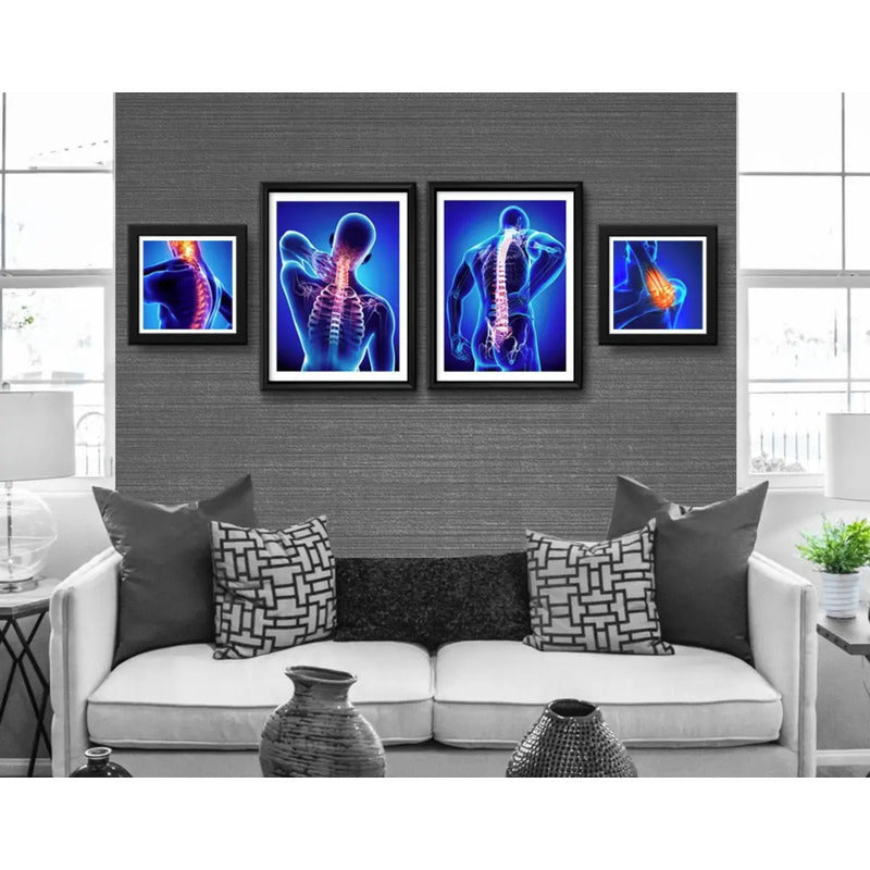 Set 4 Cuadros Ortopedia Rayos X Cuerpo Humano Clinica Medica