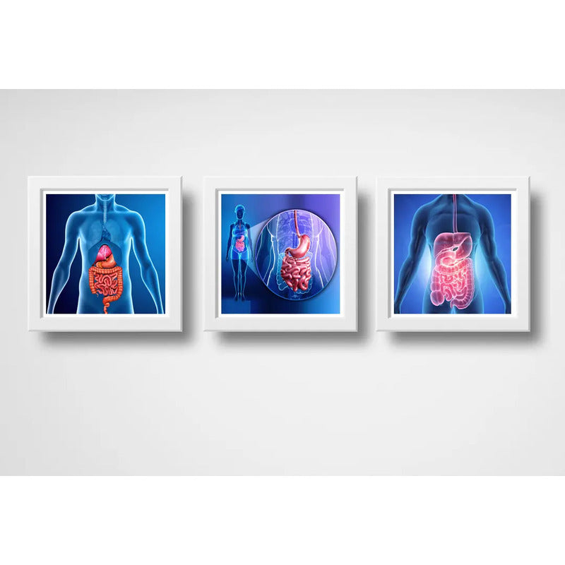 Set 3 Cuadros Gastroenterología Médico Cuerpo Humano Clinica