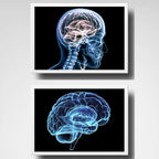 Set 2 Cuadros Neurología Médico Cuerpo Humano Decoracion