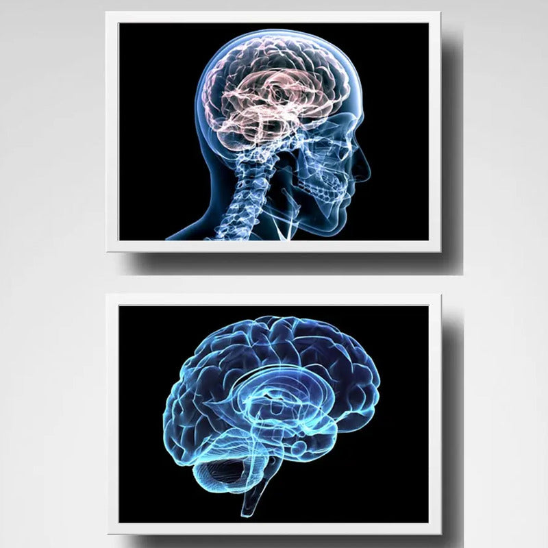 Set 2 Cuadros Neurología Médico Cuerpo Humano Decoracion