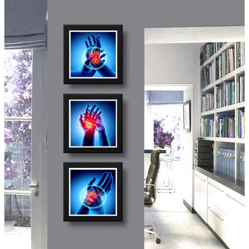 Set 3 Cuadros Ortopedia Manos Rayos X Decorar Clinica 33cm Marco Negro