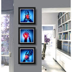 Set 3 Cuadros Ortopedia Manos Rayos X Decorar Clinica 33cm Marco Negro