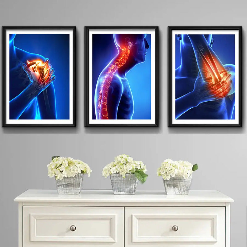 Set 3 Cuadros Ortopedia Rayos X Cuerpo Humano Medicina Decor