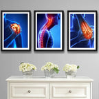 Set 3 Cuadros Ortopedia Rayos X Cuerpo Humano Medicina Decor