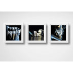 Set 3 Cuadros Implantes Dentales Dentista Clinica Estética