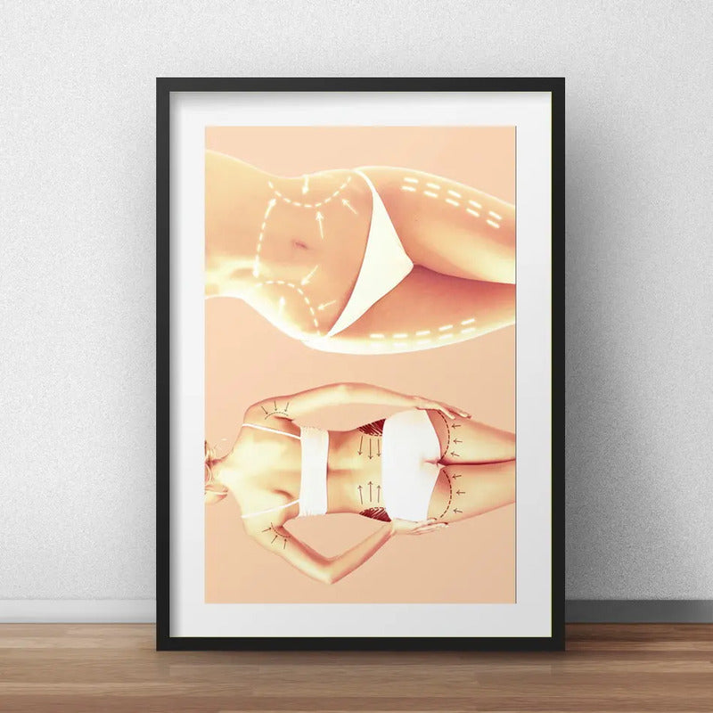 Cuadro Estetica Plastica Botox Lipo Clinica Arte Paspartu