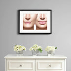 Cuadro Estetica Plastica Botox Lipo Clinica Arte Paspartu